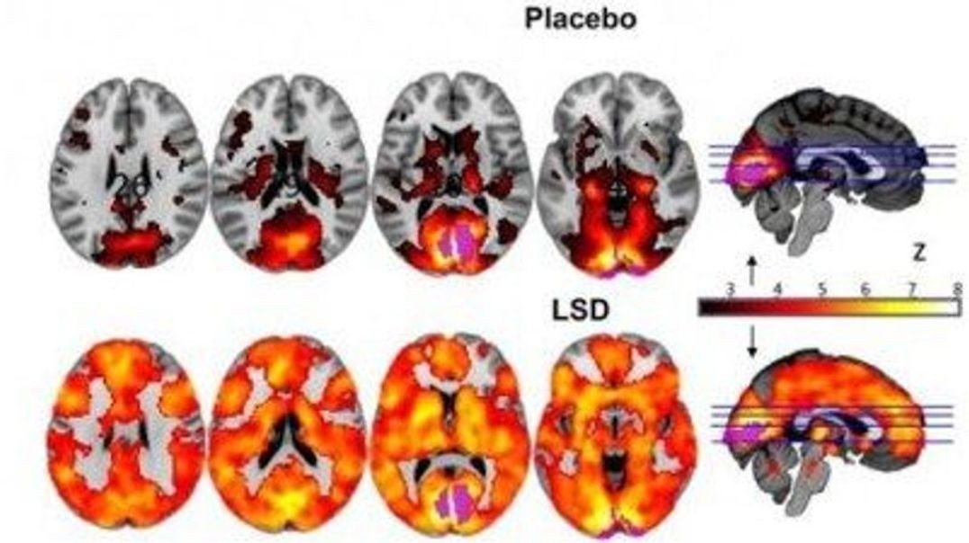 How LSD transformed Neuroscience _ Podcast Clips