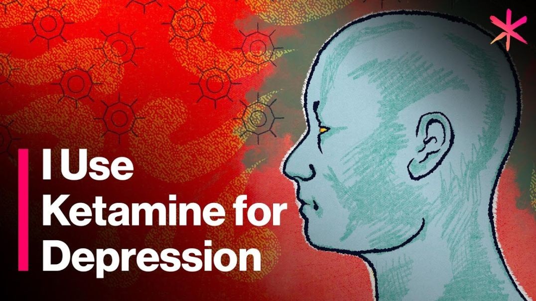 ⁣I Use Ketamine for Depression - Here’s How It Works